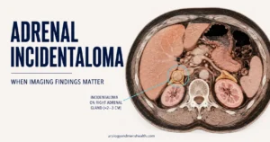 Adrenal Incidentaloma: When CT Findings Matter | UMH
