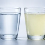 Electrolytes vs Water for Kidney Stones: What Helps